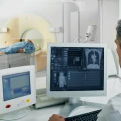 lung cancer screening